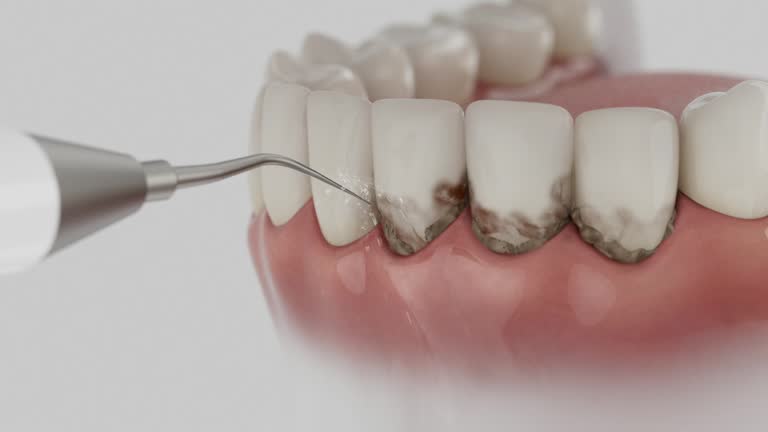 Reliable Dental contractor in Lisbon, ND by Dentist Open Now